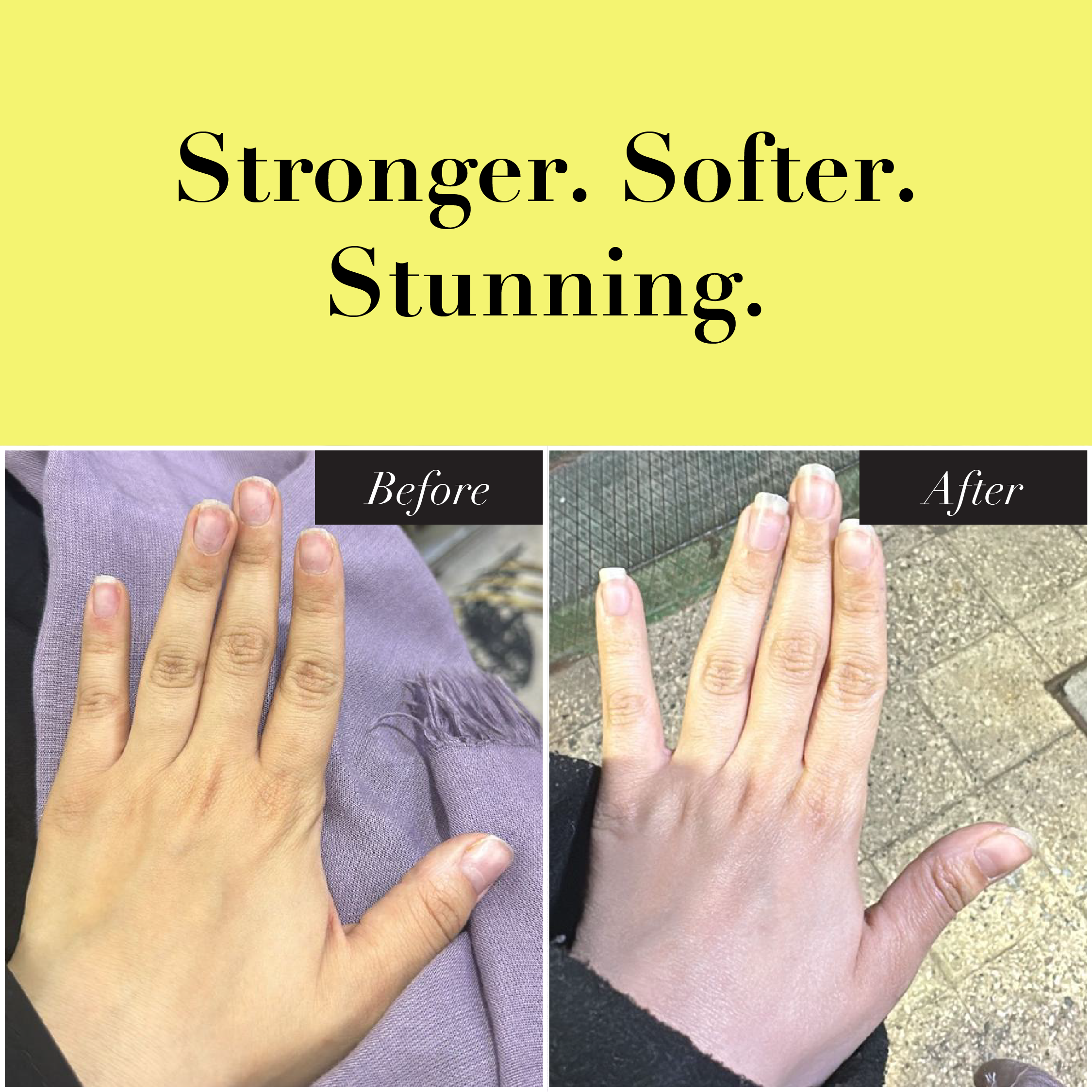 Grow My Nail Oil
